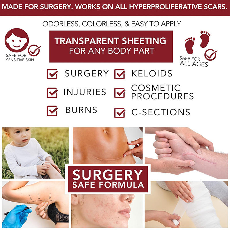 Physician Formulated Medical-Grade Silicone Scar Gel