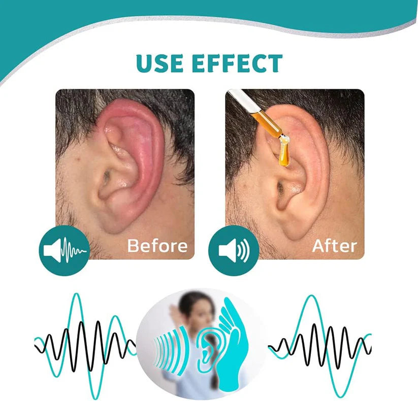 Nexisify™ Ear Drops – Plant-Based Relief | FDA-Certified for Clearer Hearing