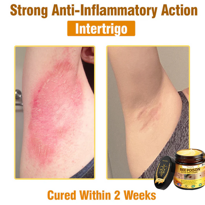 Nexisify™ Bee Venom All-in-One Cream | Clinically Tested & Dermatologist Approved