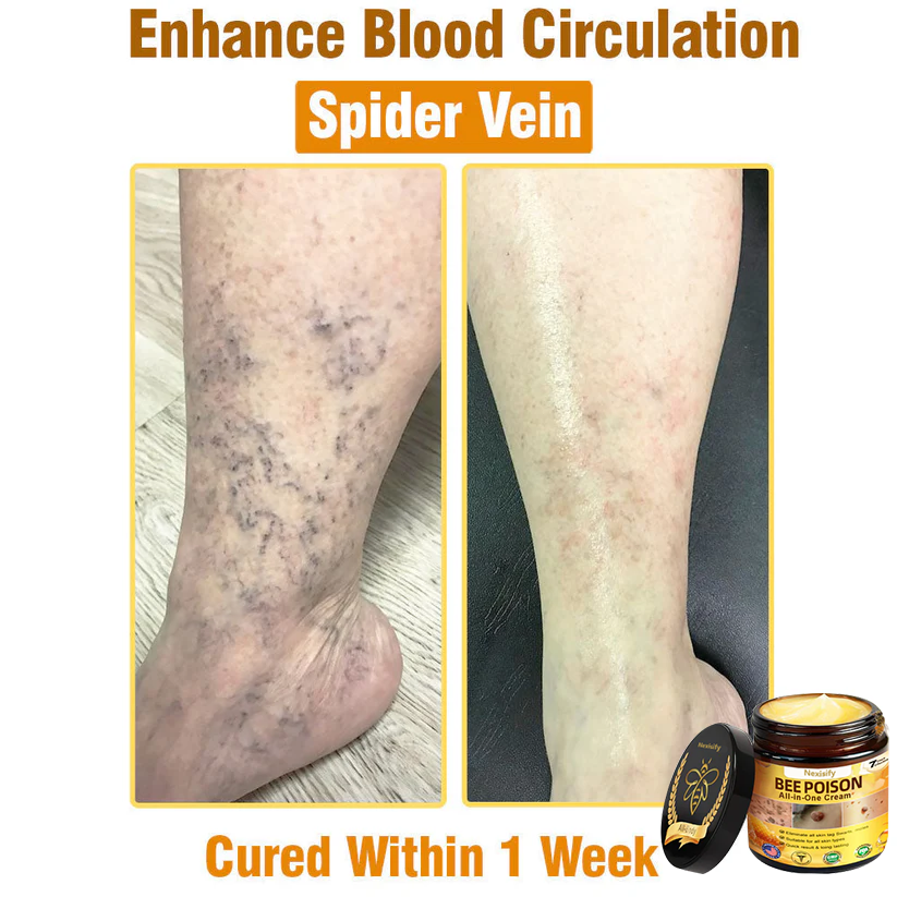 Nexisify™ Bee Venom All-in-One Cream | Clinically Tested & Dermatologist Approved