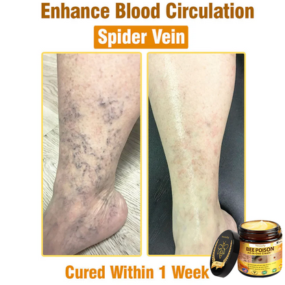 Nexisify™ Bee Venom All-in-One Cream | Clinically Tested & Dermatologist Approved