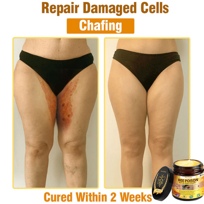 Nexisify™ Bee Venom All-in-One Cream | Clinically Tested & Dermatologist Approved