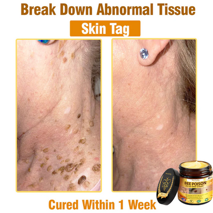 Nexisify™ Bee Venom All-in-One Cream | Clinically Tested & Dermatologist Approved