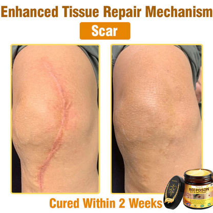 Nexisify™ Bee Venom All-in-One Cream | Clinically Tested & Dermatologist Approved