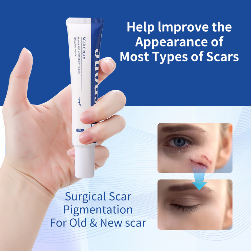 Professional Scar Removal Gel – Effective Treatment for Keloids, C-Section, Surgery, Burns, Acne & More