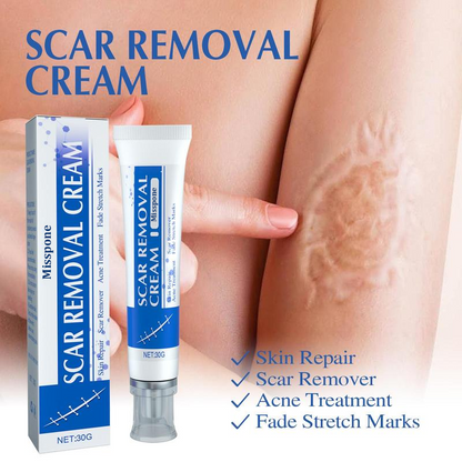 Professional Scar Removal Gel – Effective Treatment for Keloids, C-Section, Surgery, Burns, Acne & More