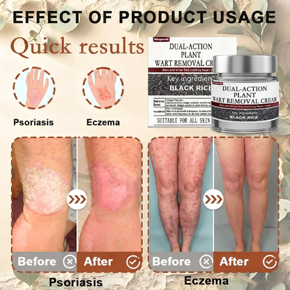 Black Rice Skin Repair Essence Cream 👨‍⚕️ FDA Certified – Helps Remove Warts, Improve Keratin Buildup, Seborrheic Dermatitis, Follicular Keratosis, Age Spots, and Bruising