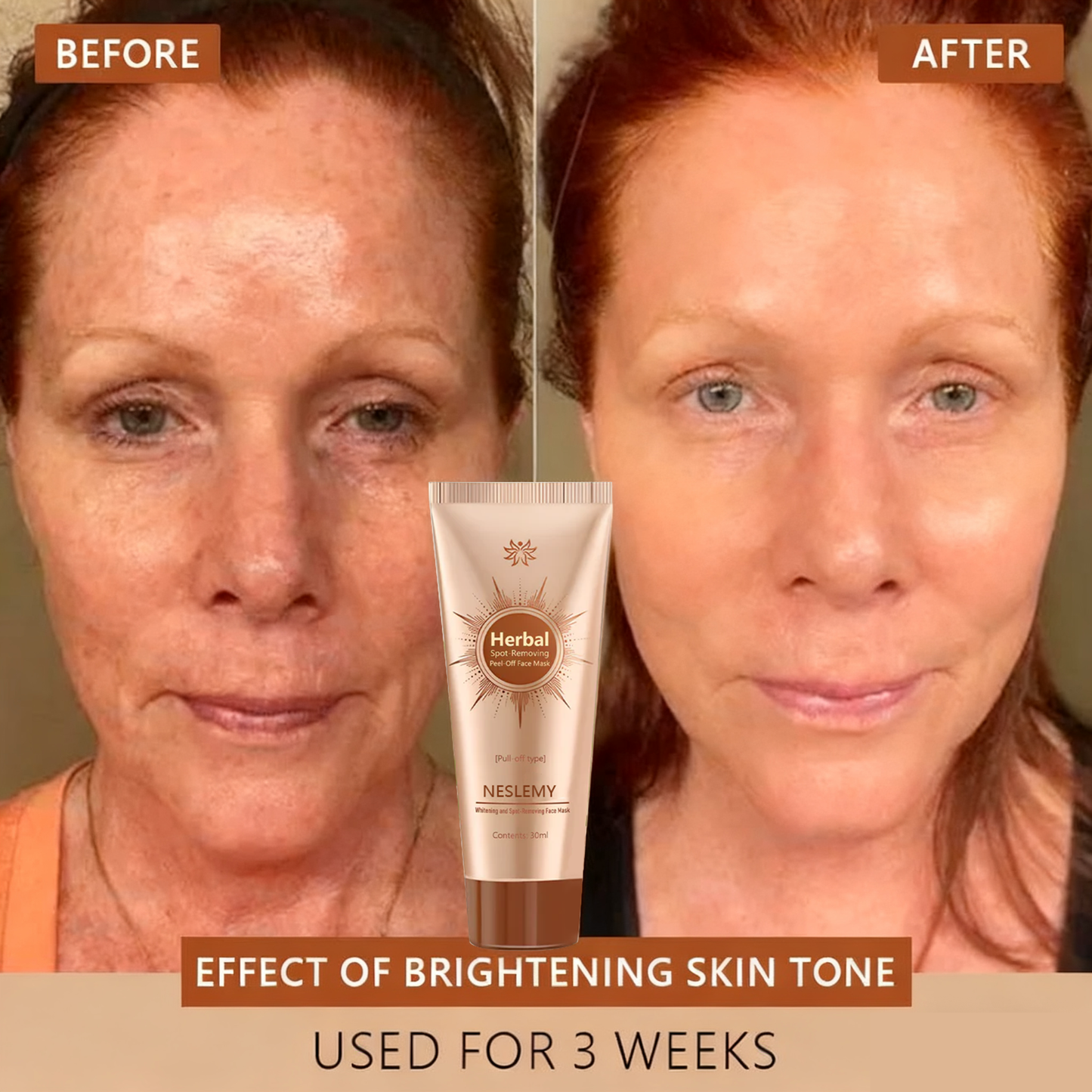 Whitening and Spot-Removing Face Mask Suitable for face and body – 👩‍⚕️ Natural ingredients permanently remove age spots, freckles, sun spots, and liver spots.