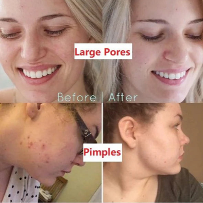 Hot Sale - Green Tea Deep Cleanse Mask