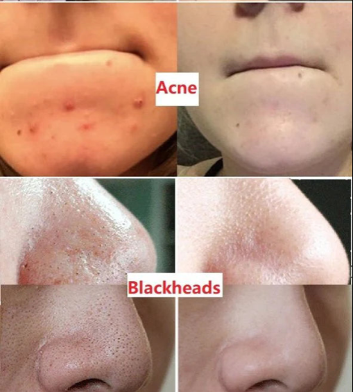 Hot Sale - Green Tea Deep Cleanse Mask