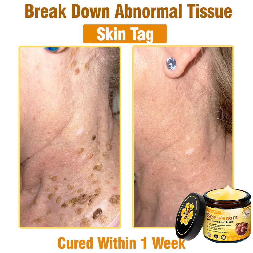 Made and Shipped from USA 🥑 Bee Venom Skin Restoration Cream ⏰ LAST DAY — 80% OFF