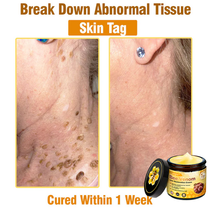Made and Shipped from USA 🥑 Bee Venom Skin Restoration Cream ⏰ LAST DAY — 80% OFF