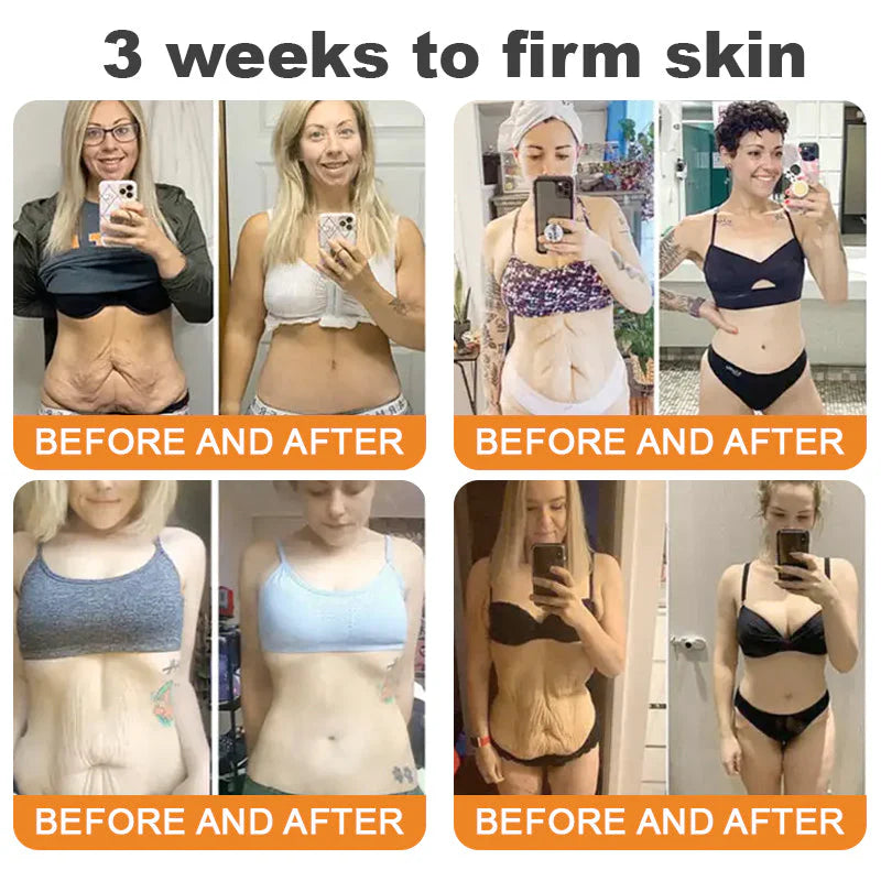 Made and Shipped from USA 🥑 Bee Venom Skin Restoration Cream ⏰ LAST DAY — 80% OFF