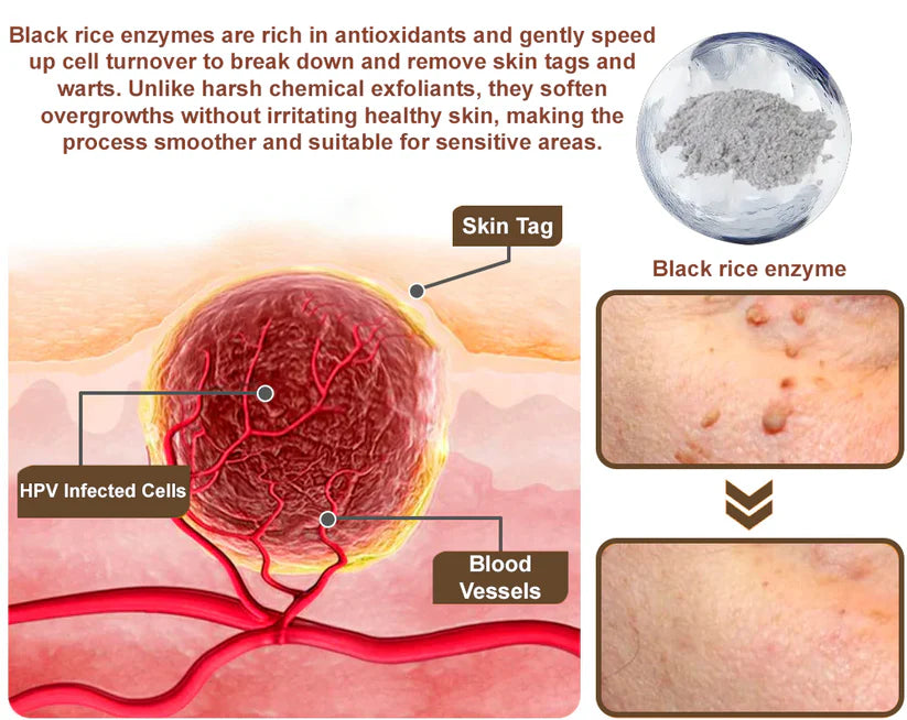 Black Rice Skin Repair Essence Cream 👨‍⚕️ FDA Certified – Helps Remove Warts, Improve Keratin Buildup, Seborrheic Dermatitis, Follicular Keratosis, Age Spots, and Bruising