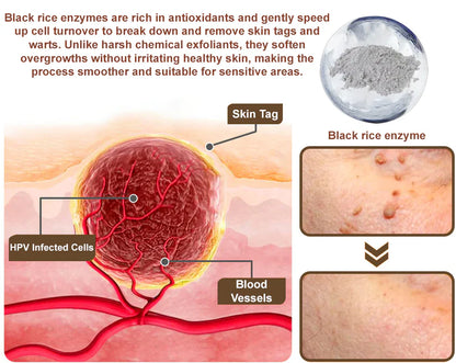 Black Rice Skin Repair Essence Cream 👨‍⚕️ FDA Certified – Helps Remove Warts, Improve Keratin Buildup, Seborrheic Dermatitis, Follicular Keratosis, Age Spots, and Bruising