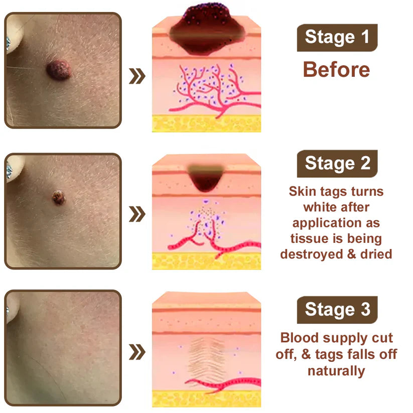 Black Rice Skin Repair Essence Cream 👨‍⚕️ FDA Certified – Helps Remove Warts, Improve Keratin Buildup, Seborrheic Dermatitis, Follicular Keratosis, Age Spots, and Bruising