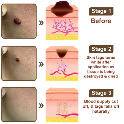 Black Rice Skin Repair Essence Cream 👨‍⚕️ FDA Certified – Helps Remove Warts, Improve Keratin Buildup, Seborrheic Dermatitis, Follicular Keratosis, Age Spots, and Bruising