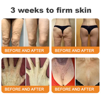 Made and Shipped from USA 🥑 Bee Venom Skin Restoration Cream ⏰ LAST DAY — 80% OFF