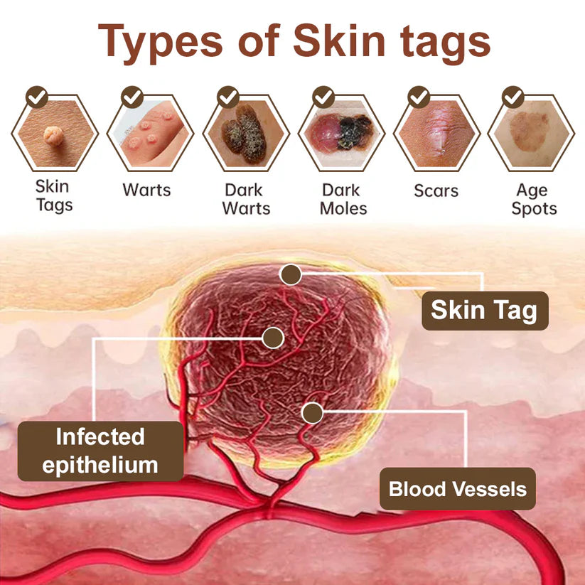 Black Rice Skin Repair Essence Cream 👨‍⚕️ FDA Certified – Helps Remove Warts, Improve Keratin Buildup, Seborrheic Dermatitis, Follicular Keratosis, Age Spots, and Bruising