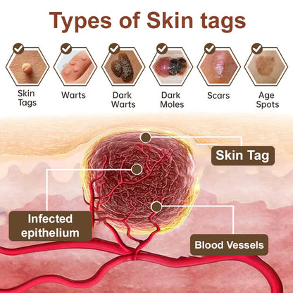 Black Rice Skin Repair Essence Cream 👨‍⚕️ FDA Certified – Helps Remove Warts, Improve Keratin Buildup, Seborrheic Dermatitis, Follicular Keratosis, Age Spots, and Bruising