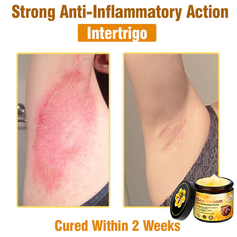 Made and Shipped from USA 🥑 Bee Venom Skin Restoration Cream ⏰ LAST DAY — 80% OFF