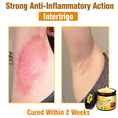 Made and Shipped from USA 🥑 Bee Venom Skin Restoration Cream ⏰ LAST DAY — 80% OFF