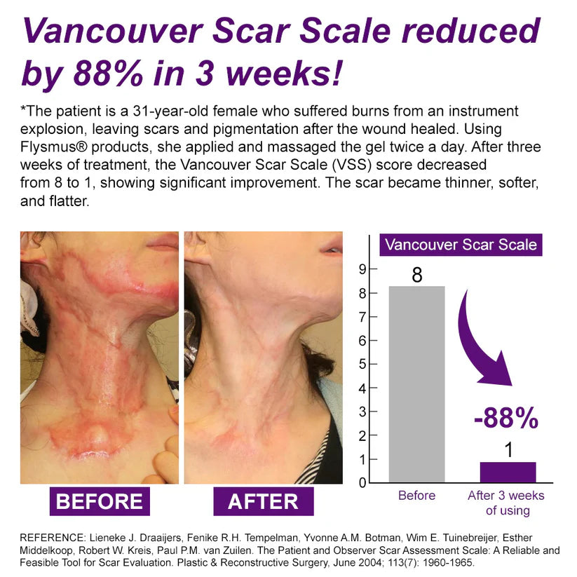 Misspone® Scar Gel – Australian Dermatology Approved for Proven Scar Repair Visible Results, Healthier Skin, Renewed Confidence