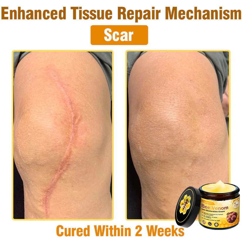 Made and Shipped from USA 🥑 Bee Venom Skin Restoration Cream ⏰ LAST DAY — 80% OFF