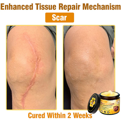 Made and Shipped from USA 🥑 Bee Venom Skin Restoration Cream ⏰ LAST DAY — 80% OFF