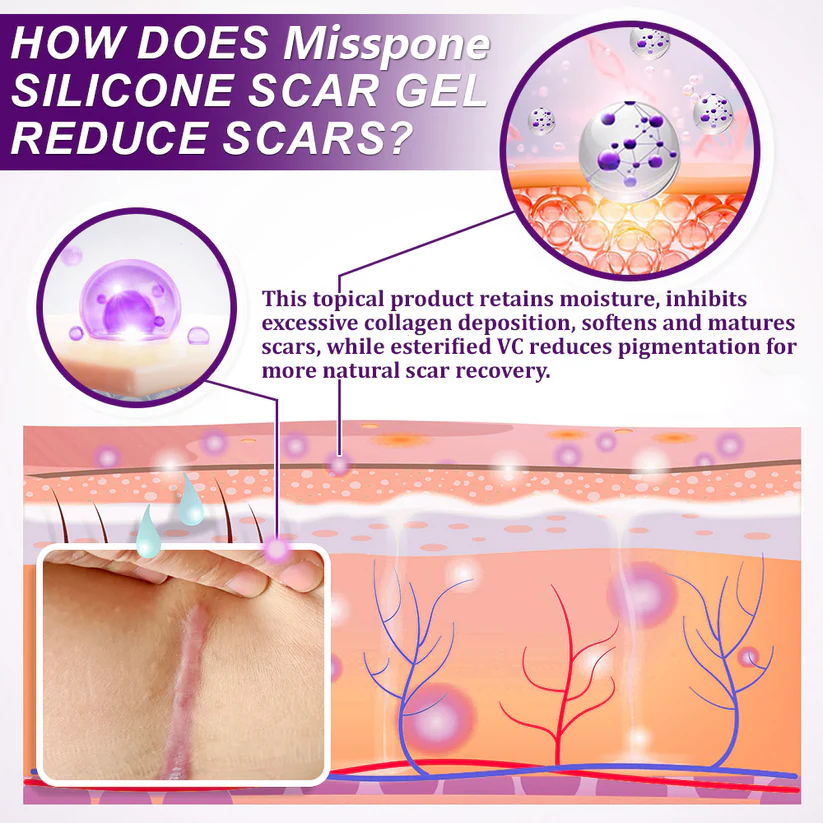 Misspone® Scar Gel – Australian Dermatology Approved for Proven Scar Repair Visible Results, Healthier Skin, Renewed Confidence