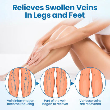 Leg Relief Varicose Veins Cream 50g – Natural Body Care Lotion to Soothe Pain, Reduce Swelling, Improve Circulation & Support Healthy, Comfortable Skin