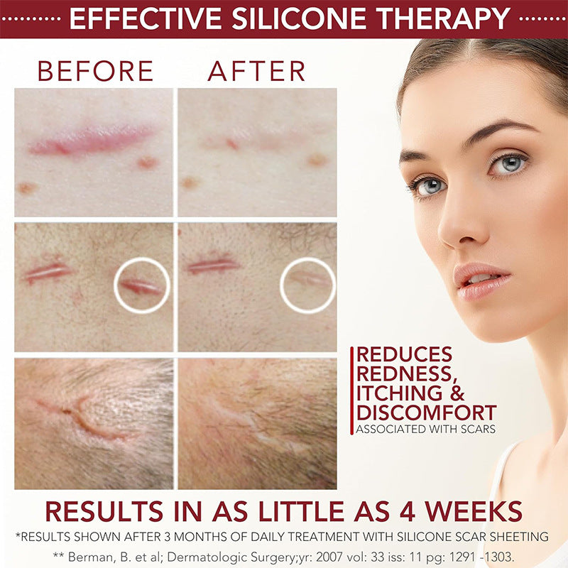 Physician Formulated Medical-Grade Silicone Scar Gel