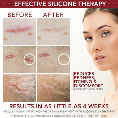 Physician Formulated Medical-Grade Silicone Scar Gel