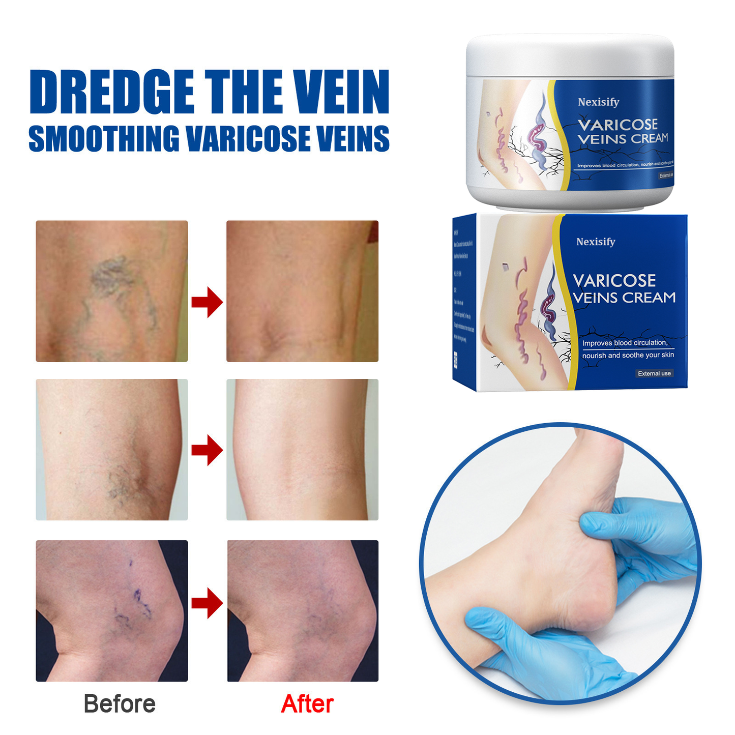 Leg Relief Varicose Veins Cream 50g – Natural Body Care Lotion to Soothe Pain, Reduce Swelling, Improve Circulation & Support Healthy, Comfortable Skin