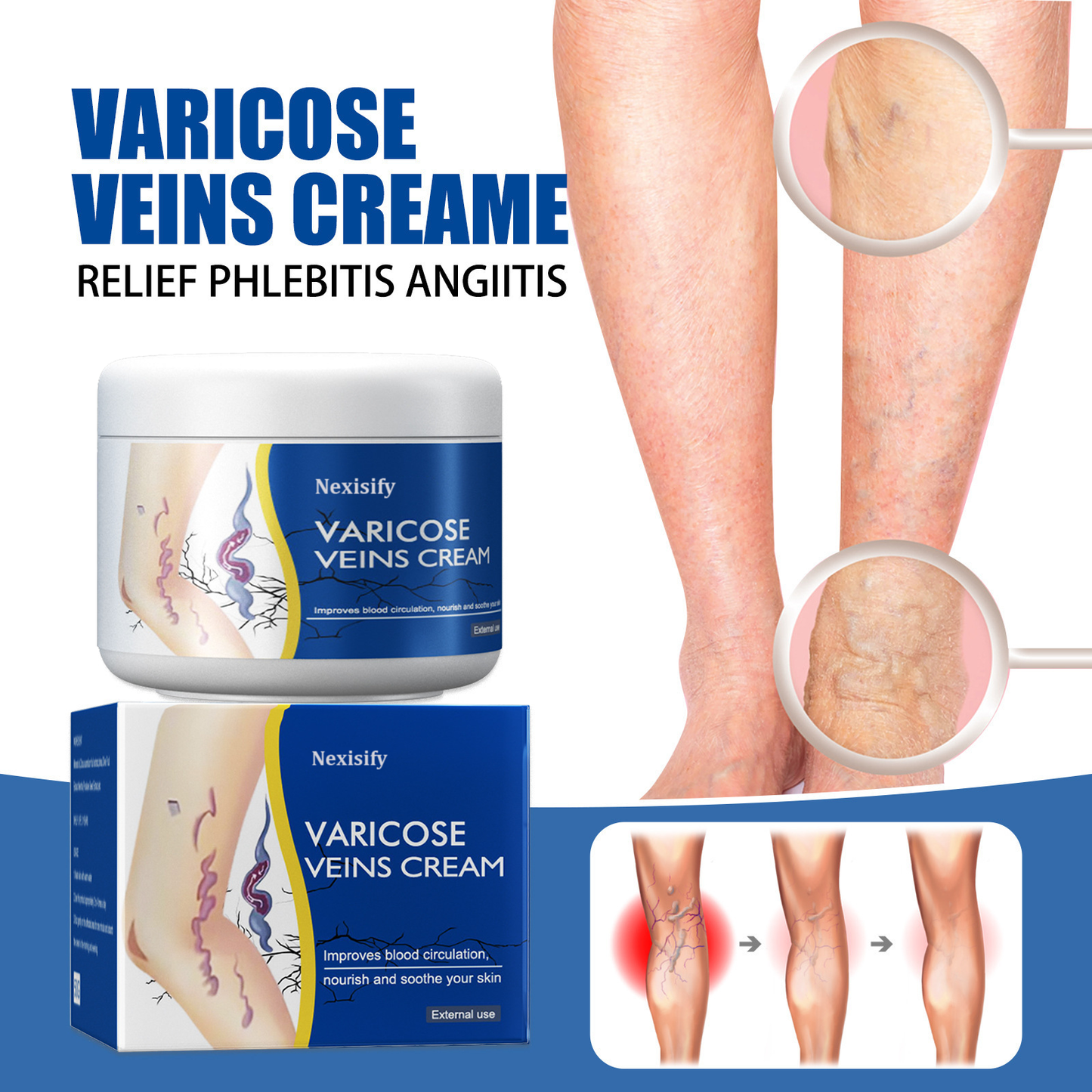 Leg Relief Varicose Veins Cream 50g – Natural Body Care Lotion to Soothe Pain, Reduce Swelling, Improve Circulation & Support Healthy, Comfortable Skin