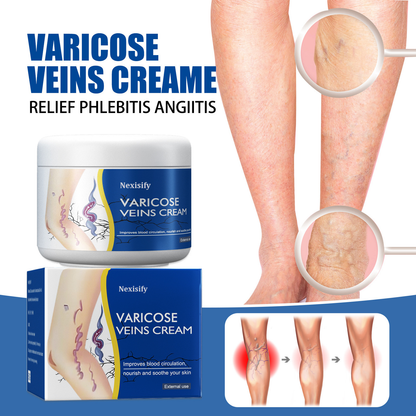 Leg Relief Varicose Veins Cream 50g – Natural Body Care Lotion to Soothe Pain, Reduce Swelling, Improve Circulation & Support Healthy, Comfortable Skin