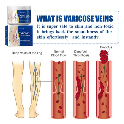 Leg Relief Varicose Veins Cream 50g – Natural Body Care Lotion to Soothe Pain, Reduce Swelling, Improve Circulation & Support Healthy, Comfortable Skin