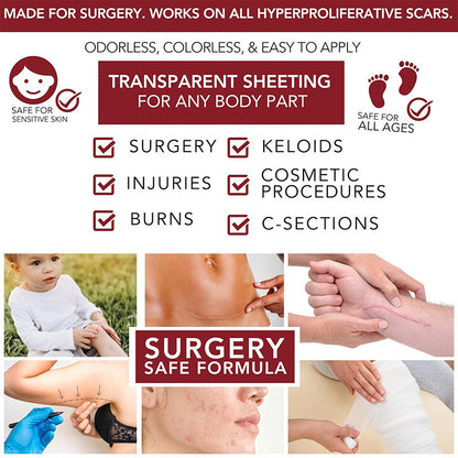 Physician Formulated Medical-Grade Silicone Scar Gel