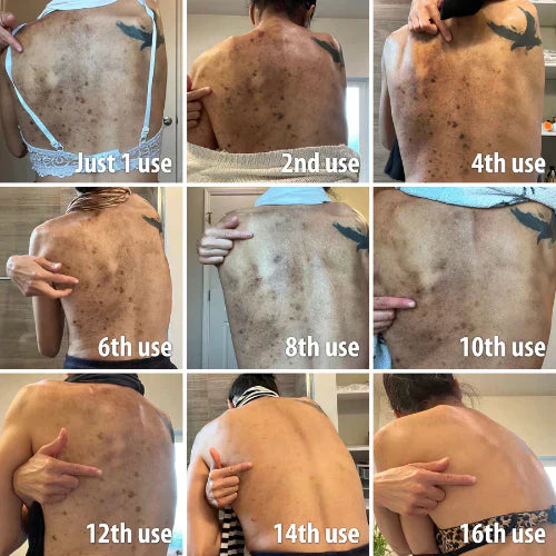 ✨Fast Dark Spot Remover – Melanin Correcting Facial Serum (🔥Last Day Promotion 60% OFF)