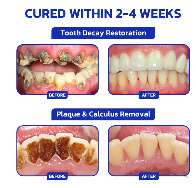 🐝 Nexisify™ Focussmile Bee Venom Oral Powder — ADA Recommended for Stronger Teeth & Gums