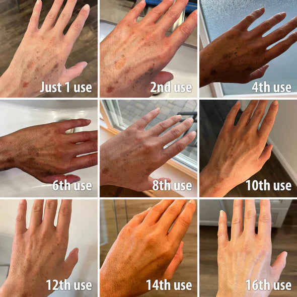 ✨Fast Dark Spot Remover – Melanin Correcting Facial Serum (🔥Last Day Promotion 60% OFF)