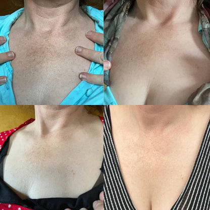 ✨Fast Dark Spot Remover – Melanin Correcting Facial Serum (🔥Last Day Promotion 60% OFF)