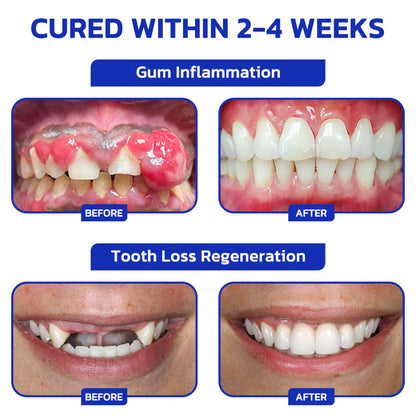 🐝 Nexisify™ Focussmile Bee Venom Oral Powder — ADA Recommended for Stronger Teeth & Gums