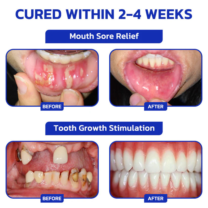 🐝 Nexisify™ Focussmile Bee Venom Oral Powder — ADA Recommended for Stronger Teeth & Gums