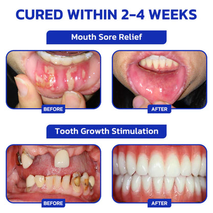 🐝 Nexisify™ Focussmile Bee Venom Oral Powder — ADA Recommended for Stronger Teeth & Gums