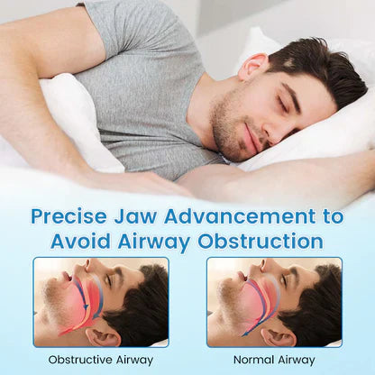 LAST DAY SALE 60% OFF⏰PerfectSleep Solution- Anti-Snoring & Anti-Grinding Teeth Protector