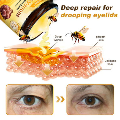 Made and Shipped from USA 🥑 Bee Venom Skin Restoration Cream ⏰ LAST DAY — 80% OFF