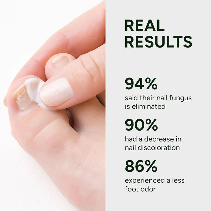 💅 Say Goodbye to Nail Fungus – Fast, Natural Relief for Healthy, Beautiful Nails 🌿